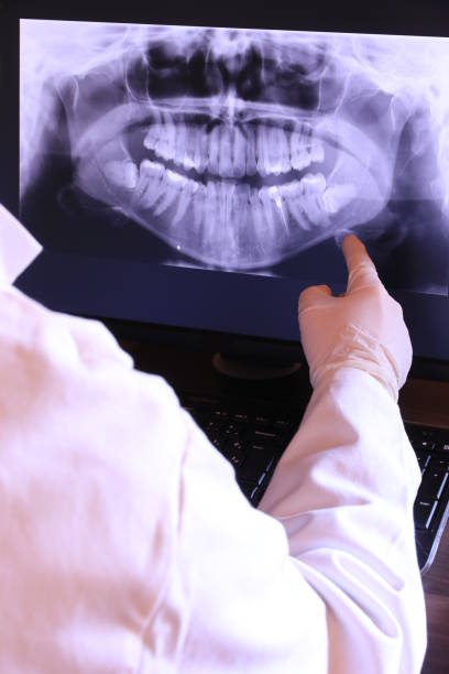 Best Emergency Dentist for Lost Fillings or Crowns in Moorhead, MS