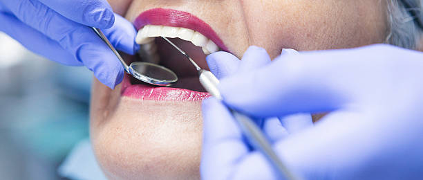 Best Emergency Dentist for Lost Fillings or Crowns in Moorhead, MS